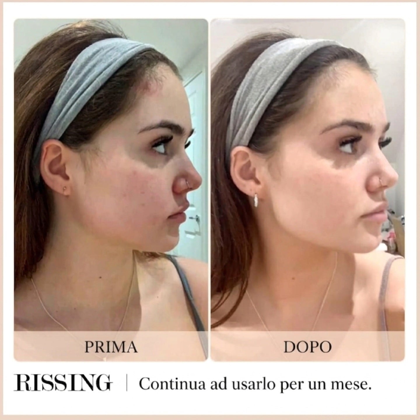 Massaggio Gua Sha Viso in Acciaio Inox Placcato Platino RISSING